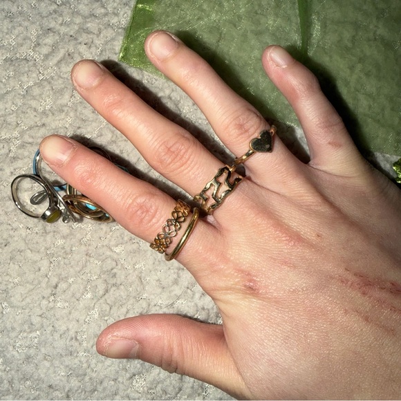 Ring Bundle - Picture 2 of 7